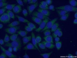 MRAP Rabbit anti-Human, Mouse, Polyclonal, Proteintech:Antibodies:Primary