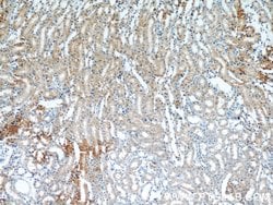 MRAP Rabbit anti-Human, Mouse, Polyclonal, Proteintech:Antibodies:Primary