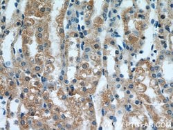 MRAP Rabbit anti-Human, Mouse, Polyclonal, Proteintech:Antibodies:Primary