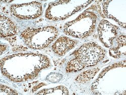 MRAP Rabbit anti-Human, Mouse, Polyclonal, Proteintech:Antibodies:Primary