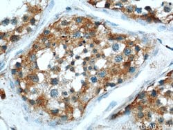 MRAP Rabbit anti-Human, Mouse, Polyclonal, Proteintech:Antibodies:Primary