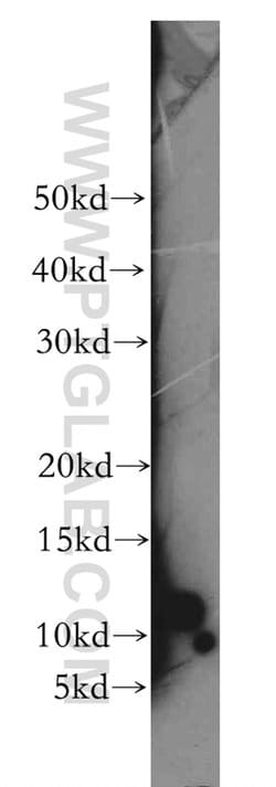 MRAP Rabbit anti-Human, Mouse, Polyclonal, Proteintech:Antibodies:Primary