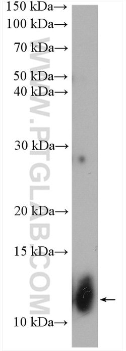 MRAP Rabbit anti-Human, Mouse, Polyclonal, Proteintech:Antibodies:Primary
