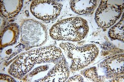 TXNRD3 Rabbit anti-Human, Polyclonal, Proteintech 150 &mu;L; Unconjugated:Antibodies,