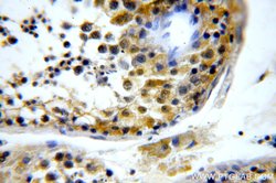 TXNRD3 Rabbit anti-Human, Polyclonal, Proteintech 150 &mu;L; Unconjugated:Antibodies,