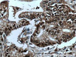 GATA4 Rabbit anti-Human, Mouse, Rat, Polyclonal, Proteintech 150 &mu;L;