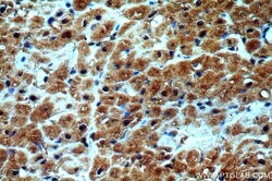 GATA4 Rabbit anti-Human, Mouse, Rat, Polyclonal, Proteintech 150 &mu;L;