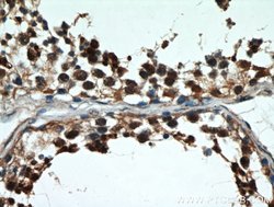 GATA4 Rabbit anti-Human, Mouse, Rat, Polyclonal, Proteintech 150 &mu;L;