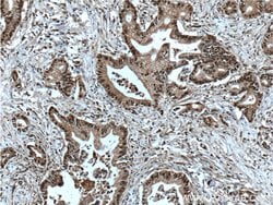 GATA4 Rabbit anti-Human, Mouse, Rat, Polyclonal, Proteintech 150 &mu;L;