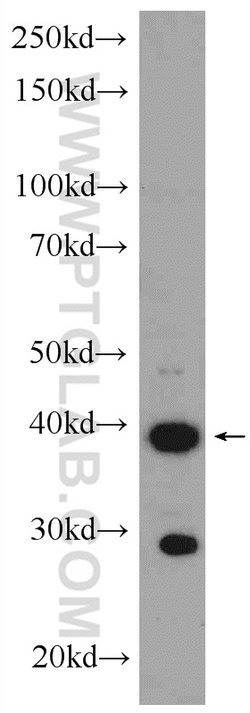 GATA4 Rabbit anti-Human, Mouse, Rat, Polyclonal, Proteintech 150 &mu;L;