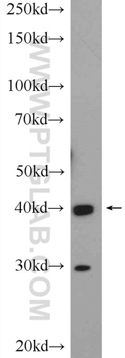GATA4 Rabbit anti-Human, Mouse, Rat, Polyclonal, Proteintech 150 &mu;L;