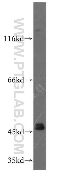 GATA4 Rabbit anti-Human, Mouse, Rat, Polyclonal, Proteintech 150 &mu;L;