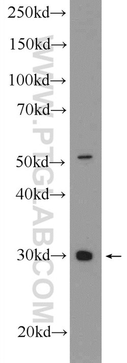 SPIN1 Rabbit anti-Human, Polyclonal, Proteintech 150 &mu;L; Unconjugated:Antibodies,
