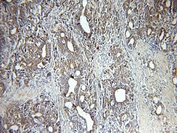 CAPG Rabbit anti-Human, Mouse, Rat, Polyclonal, Proteintech:Antibodies:Primary