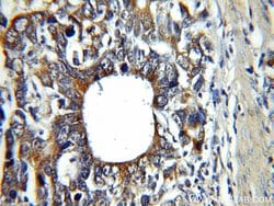 CAPG Rabbit anti-Human, Mouse, Rat, Polyclonal, Proteintech:Antibodies:Primary