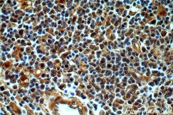CAPG Rabbit anti-Human, Mouse, Rat, Polyclonal, Proteintech:Antibodies:Primary