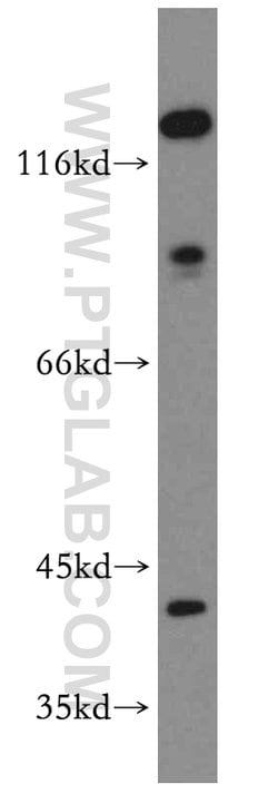 CAPG Rabbit anti-Human, Mouse, Rat, Polyclonal, Proteintech:Antibodies:Primary