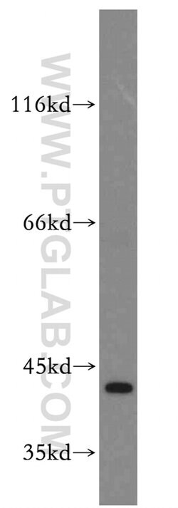 CAPG Rabbit anti-Human, Mouse, Rat, Polyclonal, Proteintech:Antibodies:Primary