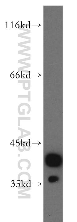 CAPG Rabbit anti-Human, Mouse, Rat, Polyclonal, Proteintech:Antibodies:Primary