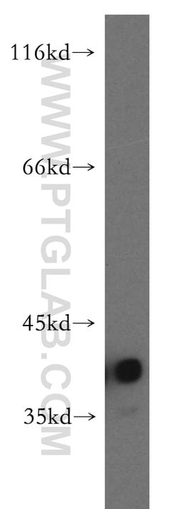 CAPG Rabbit anti-Human, Mouse, Rat, Polyclonal, Proteintech:Antibodies:Primary