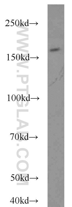 FANCA Rabbit anti-Human, Polyclonal, Proteintech:Antibodies:Primary Antibodies