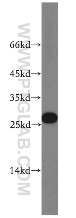 MXD1 Rabbit anti-Human, Mouse, Rat, Polyclonal, Proteintech 150 &mu;L;