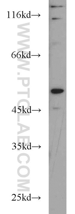 RUNX1 (N-terminal) Rabbit anti-Human, Mouse, Rat, Polyclonal, Proteintech