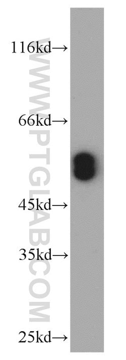 RUNX1 (N-terminal) Rabbit anti-Human, Mouse, Rat, Polyclonal, Proteintech