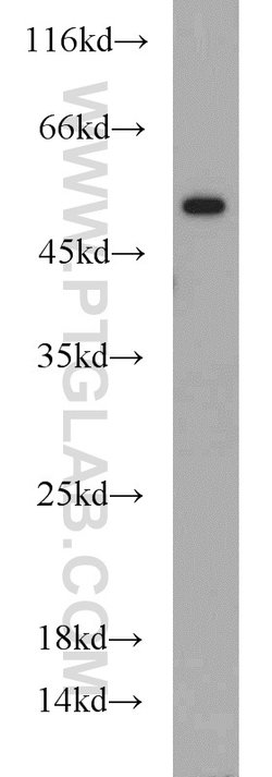 RUNX1 (N-terminal) Rabbit anti-Human, Mouse, Rat, Polyclonal, Proteintech