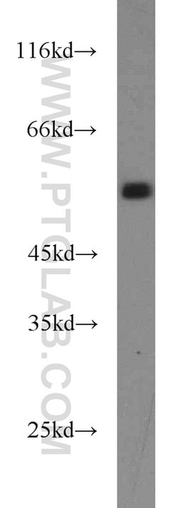 RUNX1 (N-terminal) Rabbit anti-Human, Mouse, Rat, Polyclonal, Proteintech