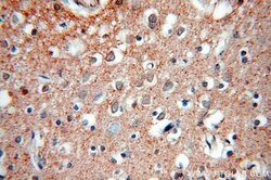 KCC2/SLC12A5 Rabbit anti-Human, Mouse, Rat, Polyclonal, Proteintech 150