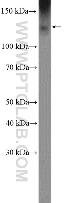 KCC2/SLC12A5 Rabbit anti-Human, Mouse, Rat, Polyclonal, Proteintech 150