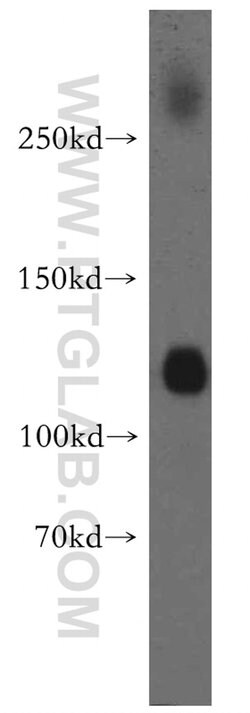 KCC2/SLC12A5 Rabbit anti-Human, Mouse, Rat, Polyclonal, Proteintech 150