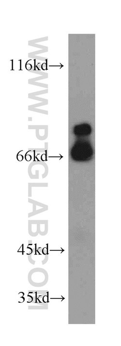 MCM-BP Rabbit anti-Human, Mouse, Rat, Polyclonal, Proteintech 150 &mu;L;