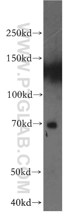 ENTPD4 Rabbit anti-Human, Mouse, Rat, Polyclonal, Proteintech:  