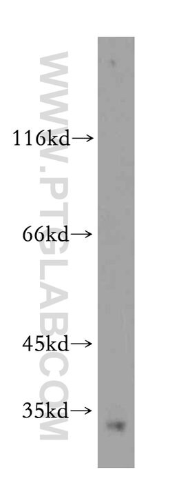 Histone H1.2 Rabbit anti-Human, Mouse, Rat, Polyclonal, Proteintech 150