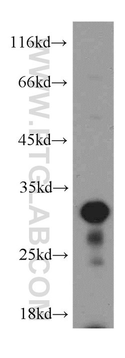 Histone H1.2 Rabbit anti-Human, Mouse, Rat, Polyclonal, Proteintech 150