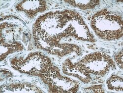 Hexokinase 1 Rabbit anti-Human, Mouse, Rat, Polyclonal, Proteintech:Antibodies:Primary