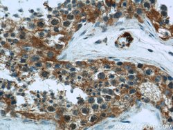 Hexokinase 1 Rabbit anti-Human, Mouse, Rat, Polyclonal, Proteintech:Antibodies:Primary