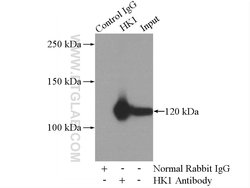 Hexokinase 1 Rabbit anti-Human, Mouse, Rat, Polyclonal, Proteintech:Antibodies:Primary