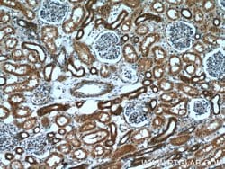 Hexokinase 1 Rabbit anti-Human, Mouse, Rat, Polyclonal, Proteintech:Antibodies:Primary