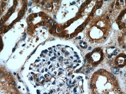 Hexokinase 1 Rabbit anti-Human, Mouse, Rat, Polyclonal, Proteintech:Antibodies:Primary