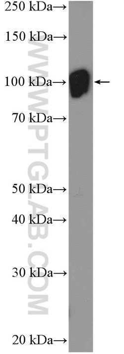 Hexokinase 1 Rabbit anti-Human, Mouse, Rat, Polyclonal, Proteintech:Antibodies:Primary