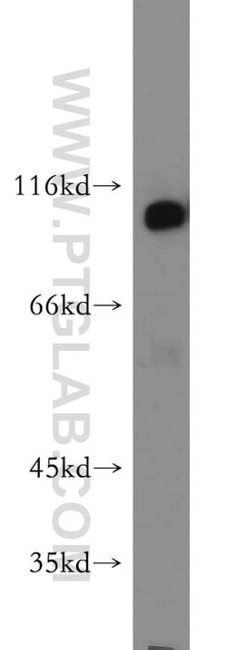 Hexokinase 1 Rabbit anti-Human, Mouse, Rat, Polyclonal, Proteintech:Antibodies:Primary