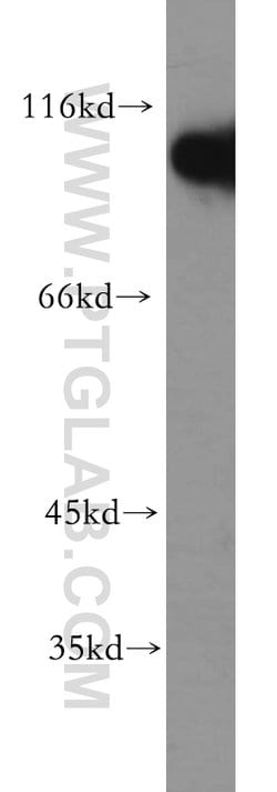 Hexokinase 1 Rabbit anti-Human, Mouse, Rat, Polyclonal, Proteintech:Antibodies:Primary