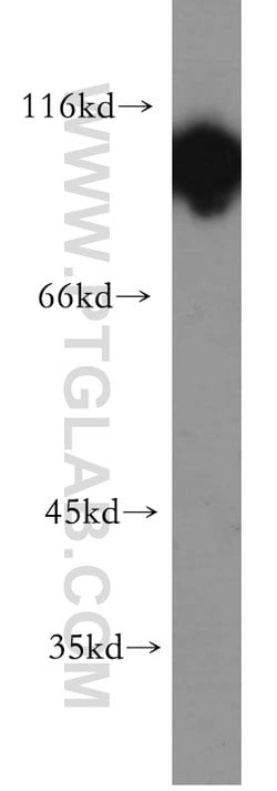 Hexokinase 1 Rabbit anti-Human, Mouse, Rat, Polyclonal, Proteintech:Antibodies:Primary