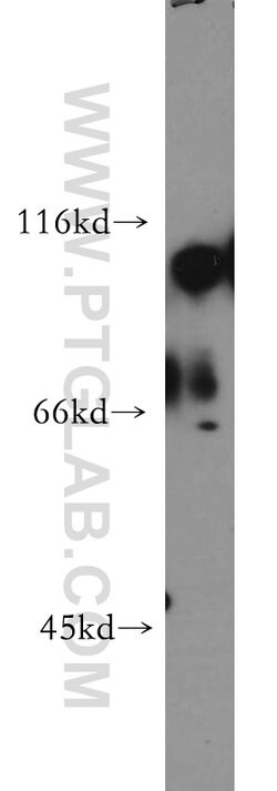 Hexokinase 1 Rabbit anti-Human, Mouse, Rat, Polyclonal, Proteintech:Antibodies:Primary