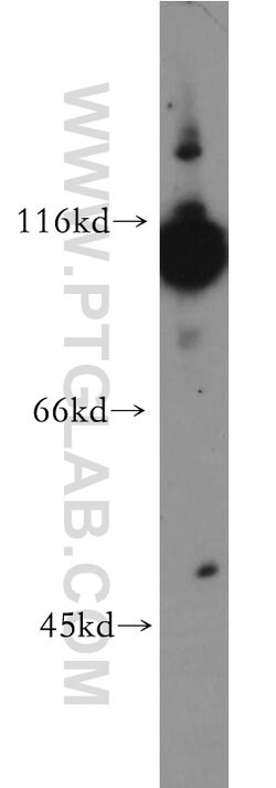 Hexokinase 1 Rabbit anti-Human, Mouse, Rat, Polyclonal, Proteintech:Antibodies:Primary