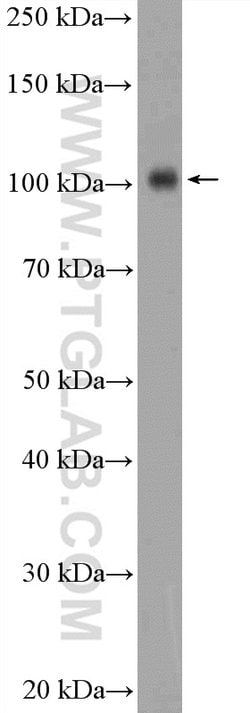 Hexokinase 1 Rabbit anti-Human, Mouse, Rat, Polyclonal, Proteintech:Antibodies:Primary