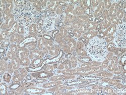Caspase 3 Rabbit anti-Human, Mouse, Rat, Polyclonal, Proteintech:Antibodies:Primary